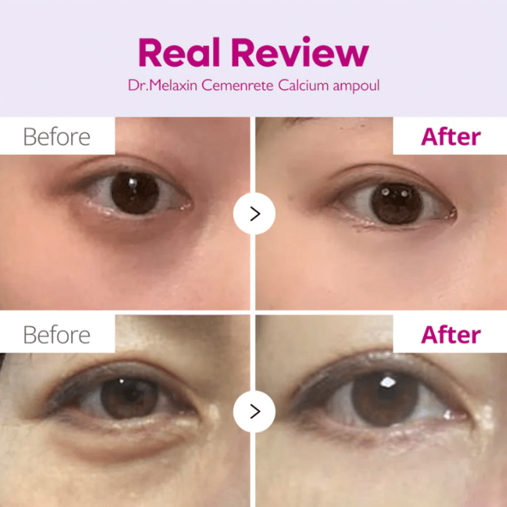 Dr. Melaxin Eyephalt Eyebag Cream 10ml