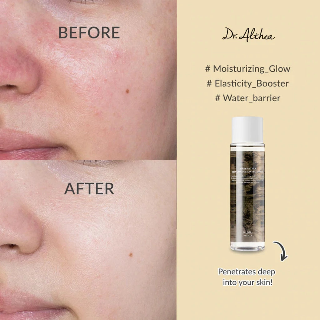 Dr. Althea Anastatica Skin Conditioning Toner - 250ml