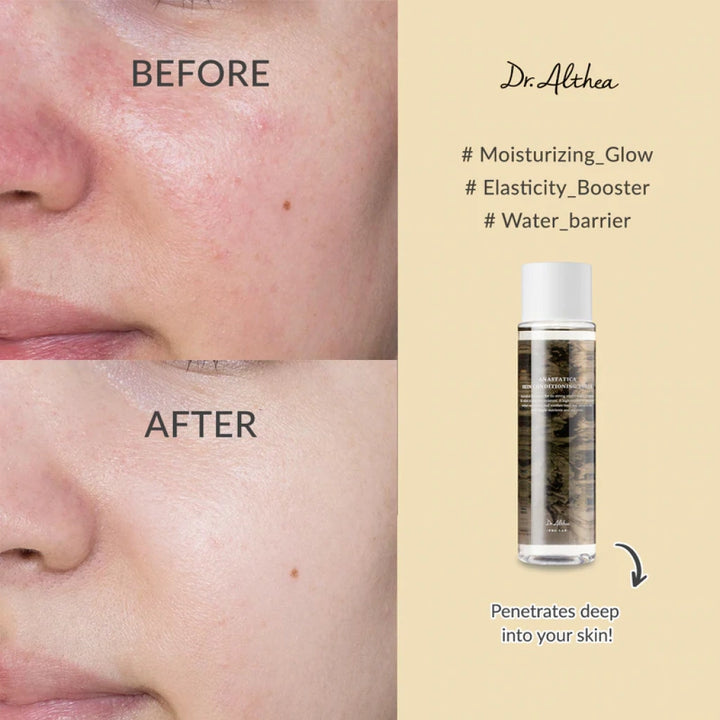 Dr. Althea Anastatica Skin Conditioning Toner - 250ml