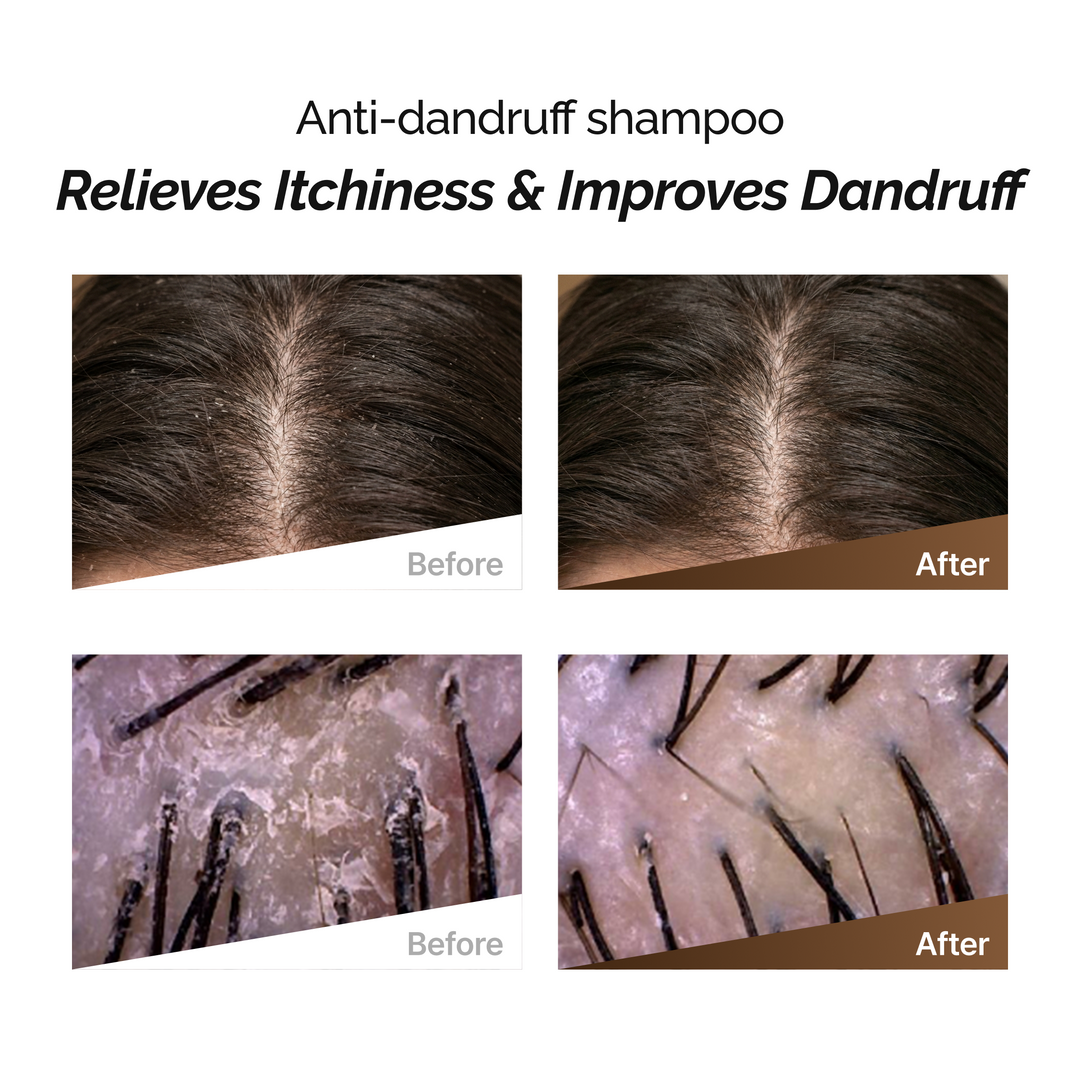 ROOTONIX Anti - Dandruff Shampoo 500ml