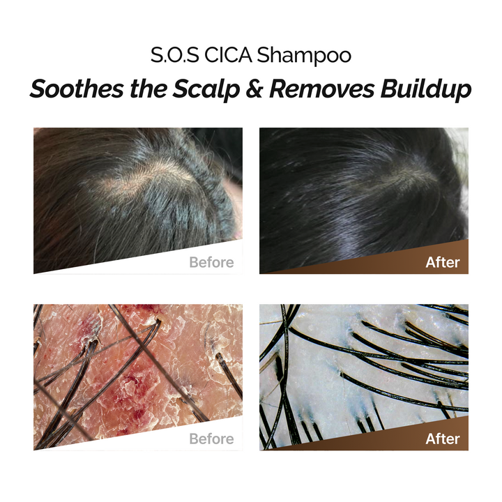 ROOTONIX S.O.S CICA Shampoo 500ml