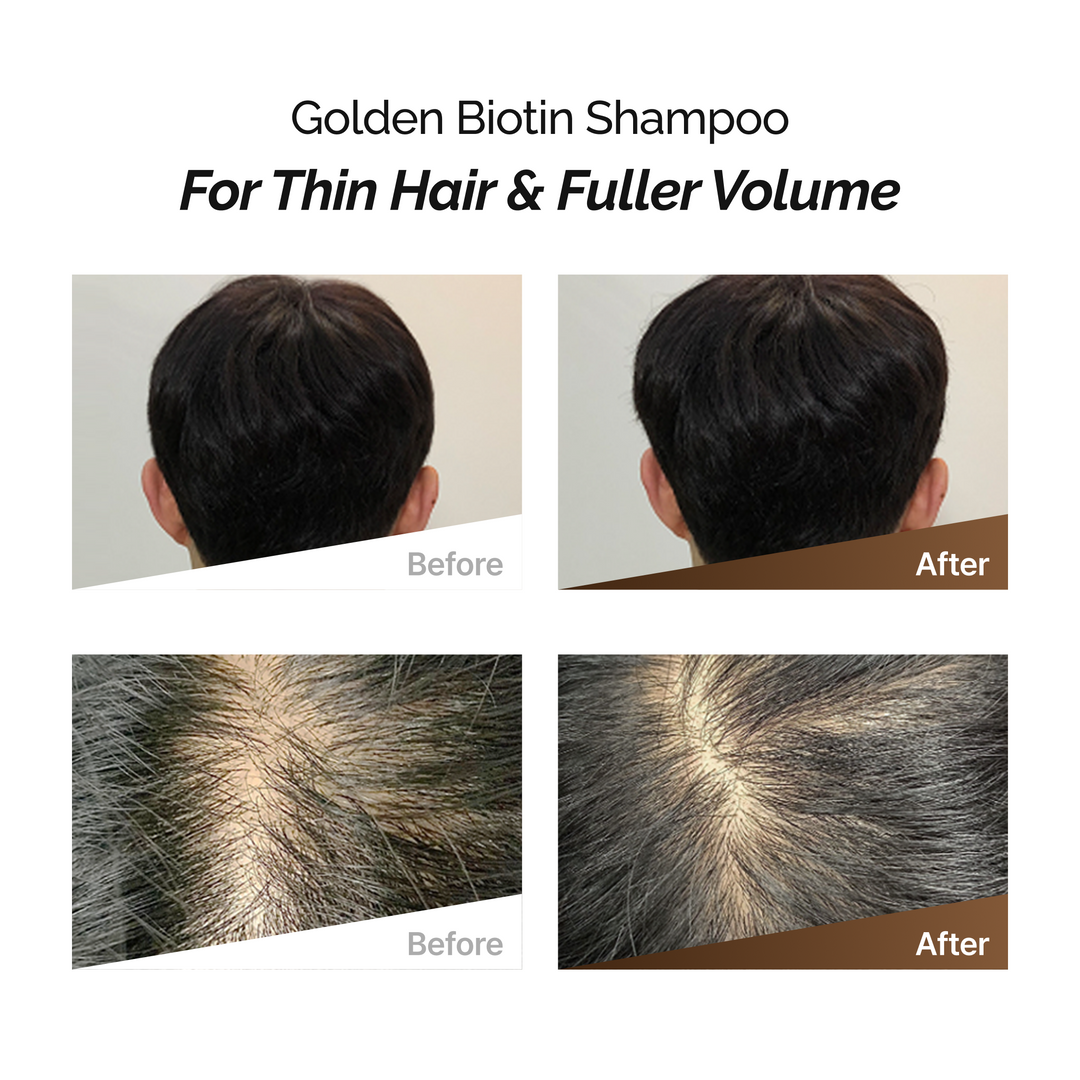 ROOTONIX Golden Biotin Shampoo 500ml