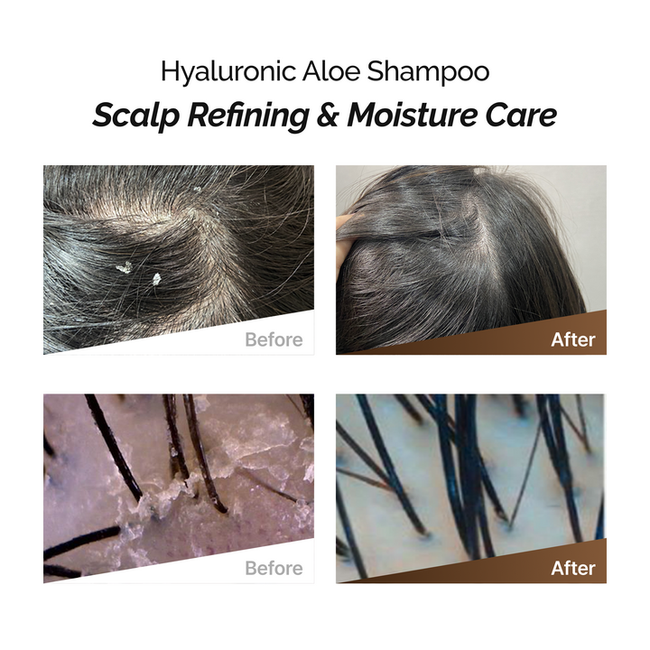 ROOTONIX Hyaluronic Aloe Shampoo 500ml