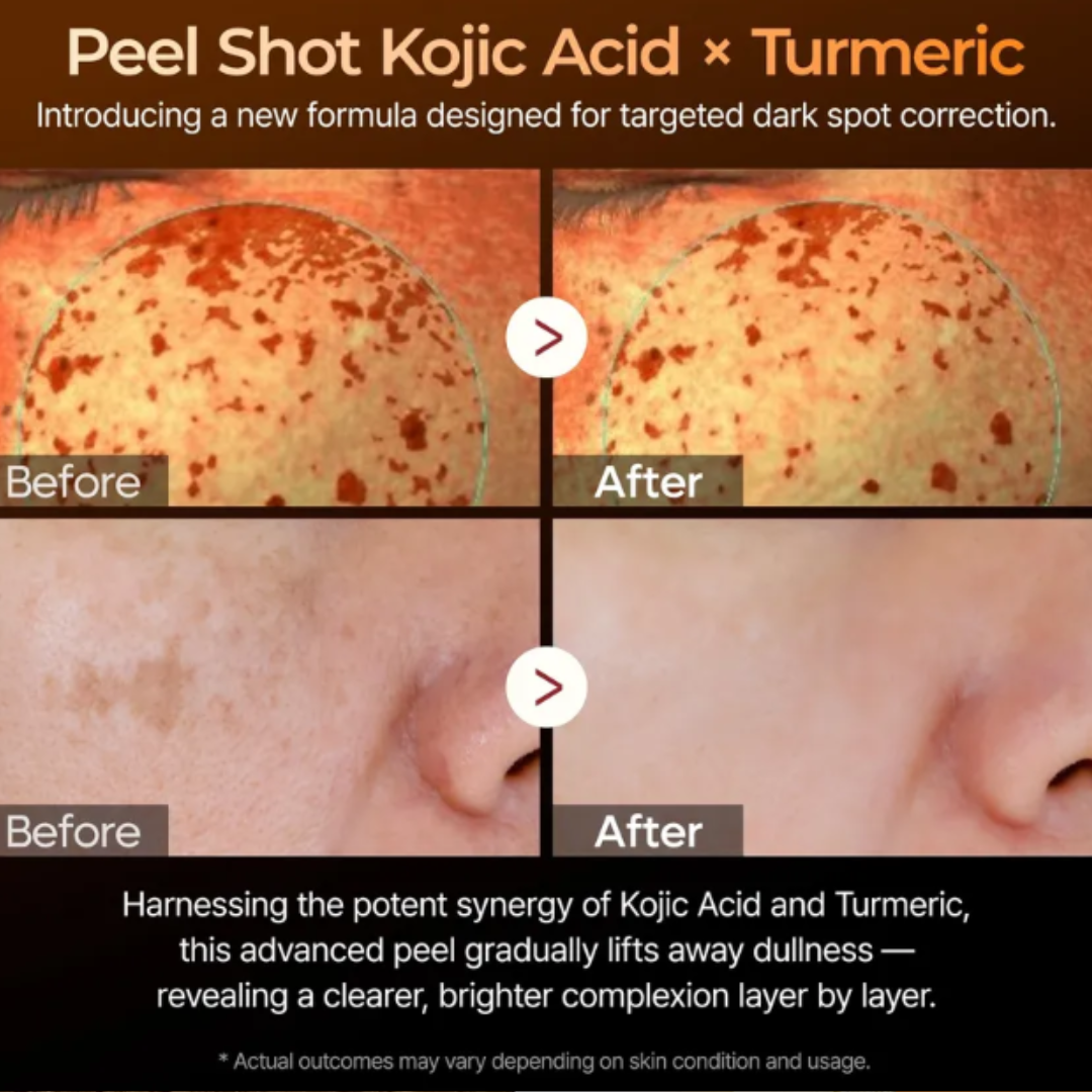 Dr.Melaxin - Peel Shot Exfoliating Kojic Acid Turmeric Serum 80 ml