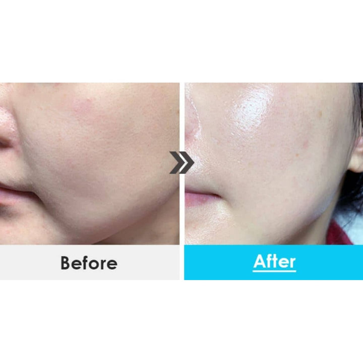 Medi Peel Power Aqua Cream 50ml