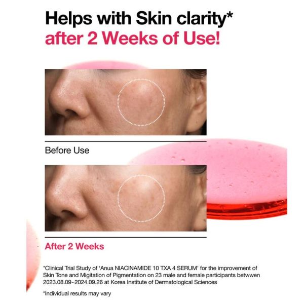 Anua Niacinamide 10% + TXA 4% Serum 30ml - Image 4